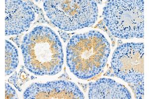 ABIN6266014 and ABIN6273185 at 1/100 staining Mouse testis tissue by IHC-P. (WBP2NL 抗体  (Internal Region))