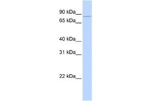 WB Suggested Anti-CPEB3 Antibody Titration: 0. (CPEB3 抗体  (Middle Region))