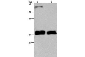 Western Blot analysis of 231 and A172 cell using FETUB Polyclonal Antibody at dilution of 1:700 (FETUB 抗体)