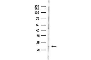 anti-NFKB Inhibitor Interacting Ras-Like 2 (NKIRAS2) (C-Term) antibody