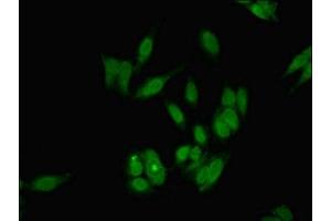 Immunofluorescent analysis of Hela cells using ABIN7154810 at dilution of 1:100 and Alexa Fluor 488-congugated AffiniPure Goat Anti-Rabbit IgG(H+L) (DKC1 抗体  (AA 94-170))