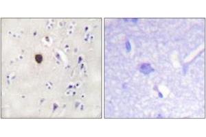 Immunohistochemistry analysis of paraffin-embedded human brain tissue, using Kir6. (KCNJ11 抗体  (AA 190-239))
