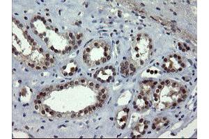 Image no. 2 for anti-Docking Protein 7 (DOK7) antibody (ABIN1497883) (DOK7 抗体)