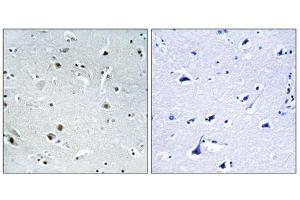 Immunohistochemistry analysis of paraffin-embedded human brain tissue using DDX24 antibody. (DDX24 抗体  (N-Term))