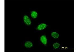 Immunofluorescence (IF) image for anti-cAMP Responsive Element Binding Protein 1 (CREB1) (AA 1-341) antibody (ABIN560460)
