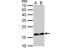 Stathmin 1 抗体  (C-Term)