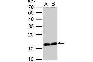 WB Image Stathmin 1 antibody detects STMN1 protein by Western blot analysis. (Stathmin 1 抗体  (C-Term))