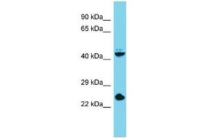 Host: Rabbit Target Name: Stra8 Sample Type: Mouse Liver lysates Antibody Dilution: 1. (STRA8 抗体  (C-Term))