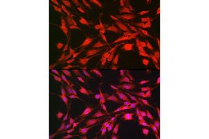 Immunofluorescence analysis of C6 cells using p70 S6 Kinase 1 Rabbit pAb (ABIN7270029) at dilution of 1:100 (40x lens). (RPS6KB1 抗体  (AA 361-525))
