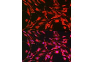 Immunofluorescence analysis of C6 cells using p70 S6 Kinase 1 Rabbit pAb (ABIN7270029) at dilution of 1:100 (40x lens). (RPS6KB1 抗体  (AA 361-525))