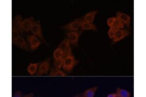 Immunofluorescence analysis of HeLa cells using DCN Polyclonal Antibody at dilution of 1:100 (40x lens). (Decorin 抗体)