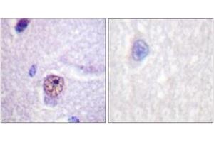 Immunohistochemistry analysis of paraffin-embedded human brain tissue, using SF1 (Ab-82) Antibody. (Splicing Factor 1 抗体  (AA 48-97))