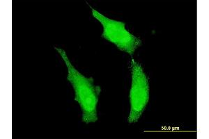 Immunofluorescence of monoclonal antibody to DND1 on HeLa cell. (DND1 抗体  (AA 167-260))