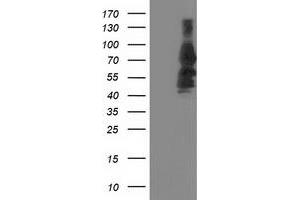 Western Blotting (WB) image for anti-Katanin P80 (WD Repeat Containing) Subunit B 1 (KATNB1) antibody (ABIN1498992) (KATNB1 抗体)