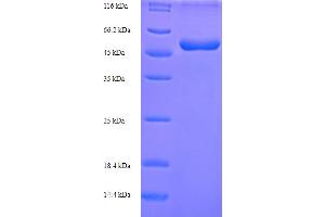 SDS-PAGE (SDS) image for Abhydrolase Domain Containing 11 (ABHD11) (AA 1-307), (full length) protein (His-SUMO Tag) (ABIN5711511) (ABHD11 Protein (AA 1-307, full length) (His-SUMO Tag))