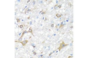 Immunohistochemistry of paraffin-embedded rat brain using IL22 antibody at dilution of 1:100 (40x lens). (IL-22 抗体)