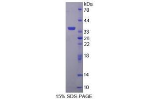 SDS-PAGE analysis of Human TP Protein. (TBXA2R 蛋白)
