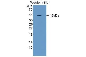 Detection of Recombinant NLRP3, Mouse using Polyclonal Antibody to NLR Family, Pyrin Domain Containing Protein 3 (NLRP3) (NLRP3 抗体  (AA 671-1033))
