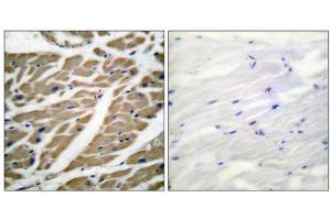 Immunohistochemical analysis of paraffin-embedded human heart tissue using Sodium Channel-pan antibody (ABIN5976507). (Sodium Channel 抗体  (Internal Region, pan))