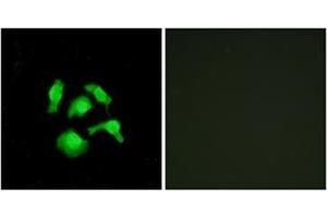 Immunofluorescence analysis of HepG2 cells, using TSC22D1 Antibody . (TSC22D1 抗体  (N-Term))