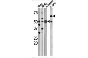 The anti-Phospho-CDC25A-S75 Pab (ABIN389531 and ABIN2839579) is used in Western blot to detect Phospho-CDC25A-S75 in, form left to right, Hela, HL60, mouse kidney, and mouse liver tissue lysates.
