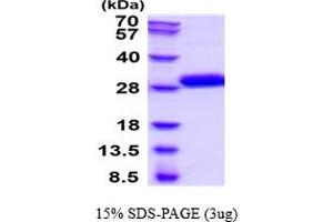 SDS-PAGE (SDS) image for Kallikrein 7 (KLK7) (AA 1-181) protein (His tag) (ABIN6387824)