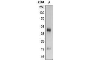 Western blot analysis of Caspase 4 p20 expression in Ramos (A) whole cell lysates. (Caspase 4 p20 (Center) 抗体)