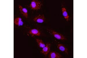 IF analysis of TST using anti-TST antibody (ABIN7599105). (TST 抗体  (AA 1-220))