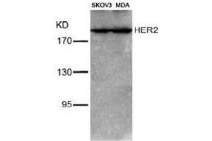 Image no. 3 for anti-Receptor tyrosine-protein kinase erbB-2 (ErbB2/Her2) (Tyr1221), (Tyr1222) antibody (ABIN197225) (ErbB2/Her2 抗体  (Tyr1221, Tyr1222))