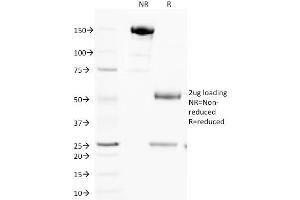 SDS-PAGE Analysis Purified Cytochrome C Monoclonal Antibody (SPM389).