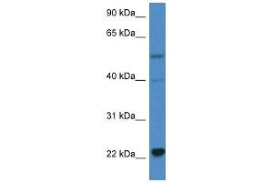 Western Blot showing IL18 antibody used at a concentration of 1 ug/ml against Hela Cell Lysate (IL-18 抗体  (C-Term))