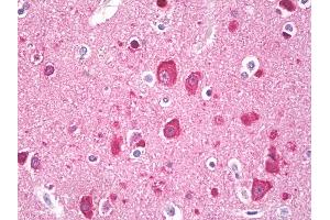 Immunohistochemistry (IHC) image for anti-Microtubule-Associated Protein 1 Light Chain 3 alpha (MAP1LC3A) (AA 1-50) antibody (ABIN1102935)