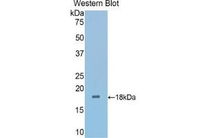 Western blot analysis of the recombinant protein. (SFRP4 抗体  (AA 27-154))
