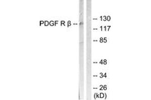 Western Blotting (WB) image for anti-Platelet Derived Growth Factor Receptor beta (PDGFRB) (AA 991-1040) antibody (ABIN2888856) (PDGFRB 抗体  (AA 991-1040))