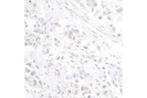 Immunohistochemistry (IHC) image for anti-Cleavage and Polyadenylation Specific Factor 3-Like (CPSF3L) (AA 550-600) antibody (ABIN7453583)