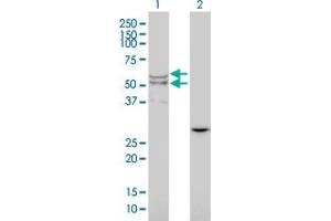 Western Blot analysis of LIPA expression in transfected 293T cell line by LIPA monoclonal antibody (M01), clone 1F9. (Lipase A 抗体  (AA 1-399))