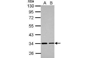 WB Image Sample (30 ug of whole cell lysate) A: A431 B: HeLa 10% SDS PAGE antibody diluted at 1:1000 (ETFA 抗体  (Center))