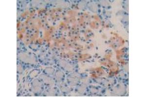DAB staining on IHC-P; Samples: Rat Pancreas Tissue (Vitamin D-Binding Protein 抗体  (AA 209-394))