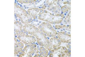 Immunohistochemistry of paraffin-embedded mouse kidney using TARS antibody (ABIN6132713, ABIN6148858, ABIN6148859 and ABIN6222758) at dilution of 1:100 (40x lens). (TARS 抗体  (AA 1-230))