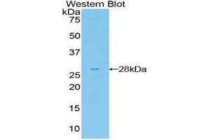 Western blot analysis of the recombinant protein. (FRS2 抗体  (AA 239-449))