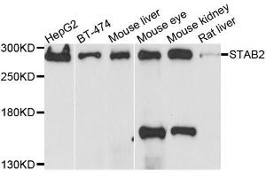 Western blot analysis of extracts of various cell lines, using STAB2 antibody. (Stabilin 2 (STAB2) (AA 1550-1850) 抗体)