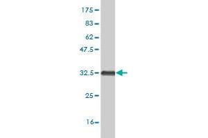 Western Blot detection against Immunogen (33 KDa) . (HOXB7 抗体  (AA 55-120))