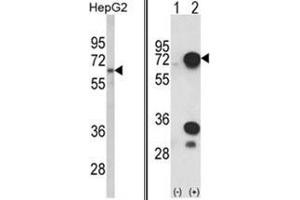 (LEFT) Western blot analysis of HNRPL Antibody (C-term) in HepG2 cell line lysates (35ug/lane). (HNRNPL 抗体  (C-Term))