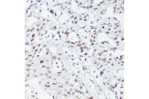 Immunohistochemistry of paraffin-embedded mouse fetal Heart using Islet1 Rabbit mAb (ABIN7268024) at dilution of 1:100 (40x lens). (ISL1 抗体)