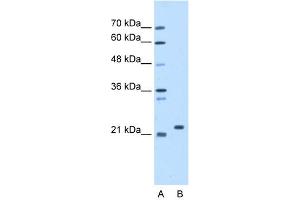 WB Suggested Anti-SDF2 Antibody Titration:  1. (SDF2 抗体  (N-Term))