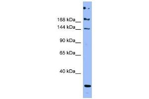 ApoB antibody used at 1 ug/ml to detect target protein. (APOB 抗体  (Middle Region))