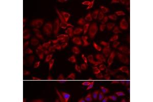 Immunofluorescence analysis of HeLa cells using CSRP3 Polyclonal Antibody (CSRP3 抗体)