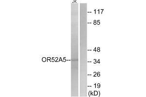 Western blot analysis of extracts from Jurkat cells, using OR52A5 antibody. (OR52A5 抗体  (Internal Region))