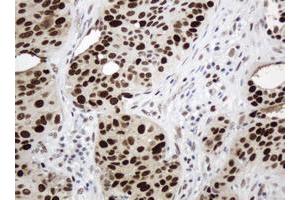 Image no. 4 for anti-Proliferating Cell Nuclear Antigen (PCNA) antibody (ABIN1500061)