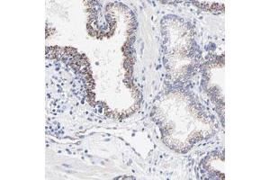 Immunohistochemical staining of human prostate with FBXO10 polyclonal antibody  shows moderate cytoplasmic positivity in glandular cells at 1:20-1:50 dilution.